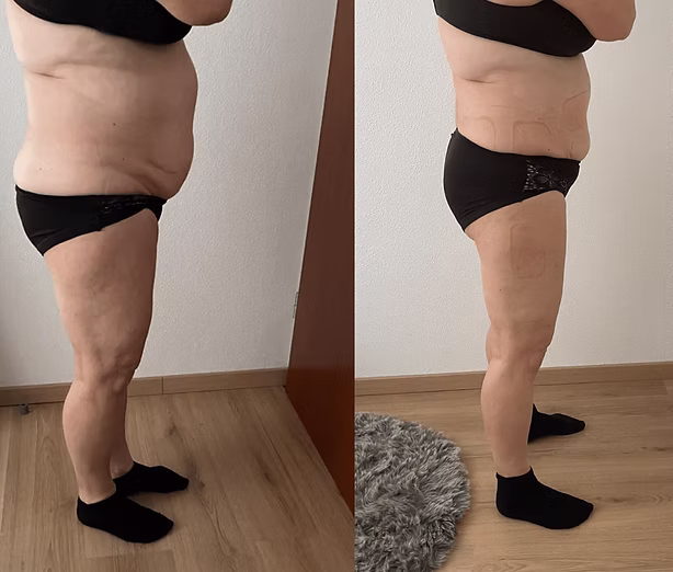 Nach 20 Behandlungen